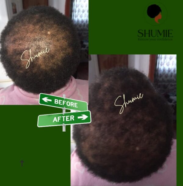 Shumie Short Hair thickening Combo - Image 2
